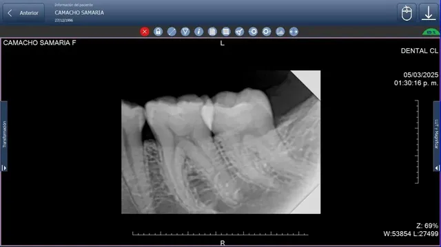 Especialista analiza una radiografía periapical en pantalla digital, aprovechando las 10 ventajas de los rayos X durante el diagnóstico.